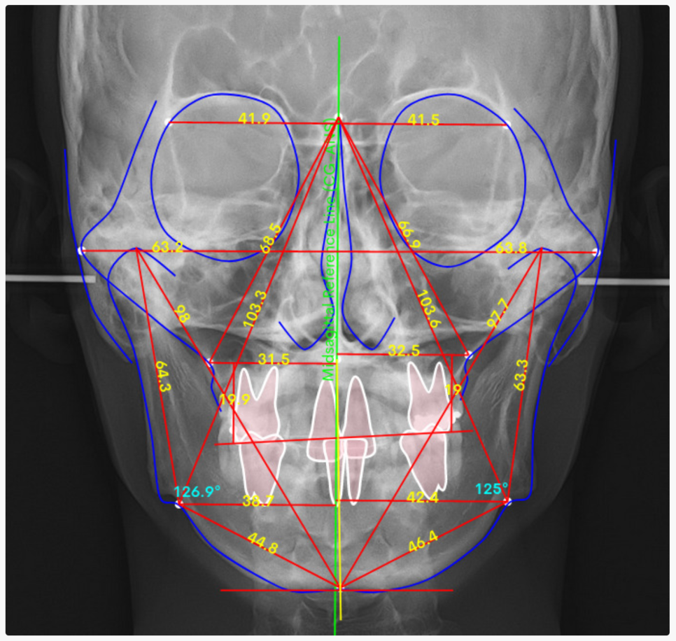 Yonsei Good Day Dental Clinic Operates WebCeph Diagnostics to Predict Pre- and Post-Orthodontic Changes image 1
