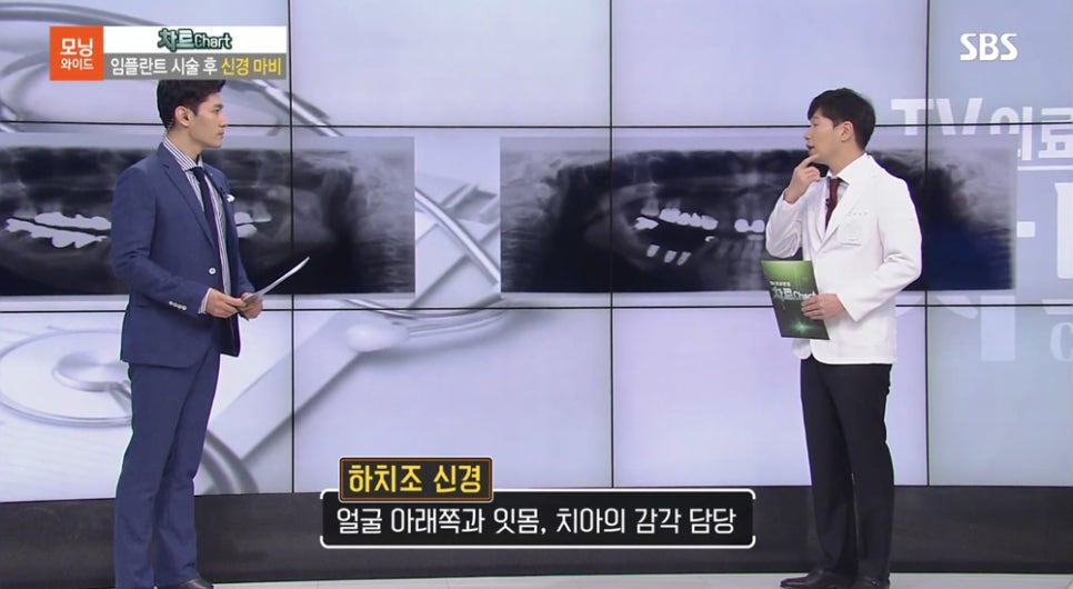 [2018.08.23] SBS모닝와이드 - 수서 연세굿데이 최세경 원장님 방송캡쳐 관련 이미지 5