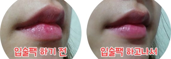 거친 입술을 촉촉하게, 입술팩, 건조한 입술관리법으로 굿! 꾸준히 쓰려구요~ 관련 이미지 10