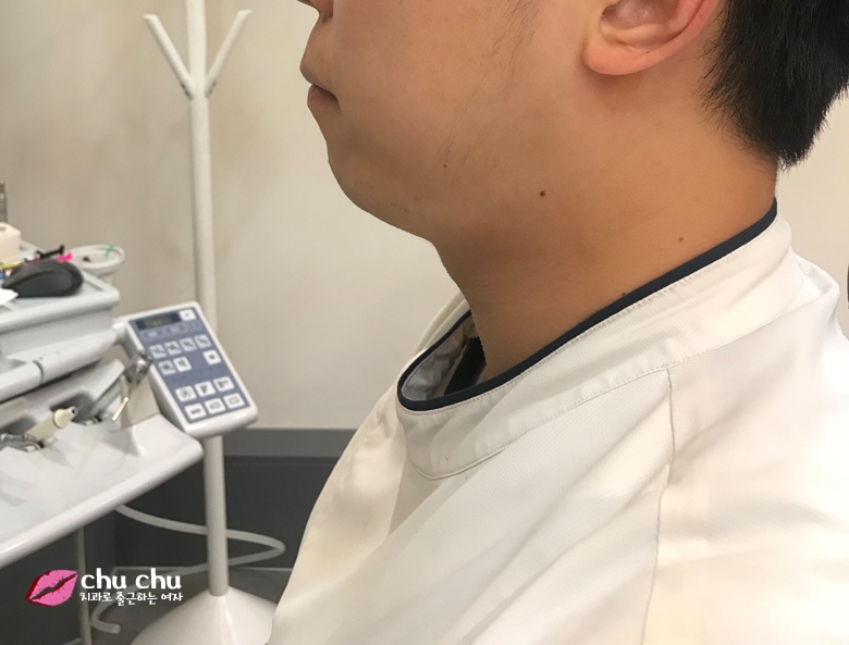 남자돌출입교정전후 - 지금도 ing 관련 이미지 3