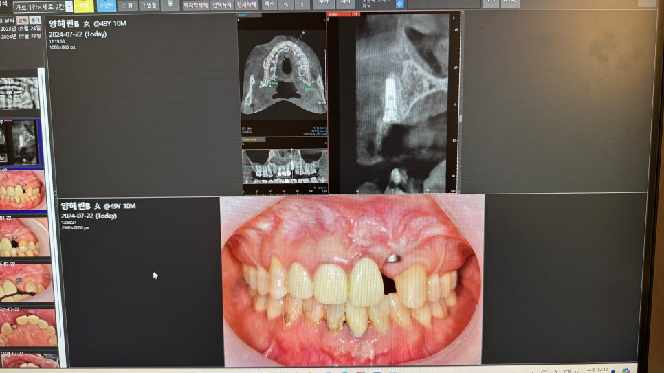 3Shape 트리오스5 구강스캐너 장비 추가 도입했습니다 관련 이미지 8