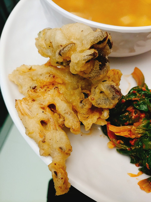 울 치과 점심 메뉴, 한식부페 부럽지 않아요 ㅎ 관련 이미지 4