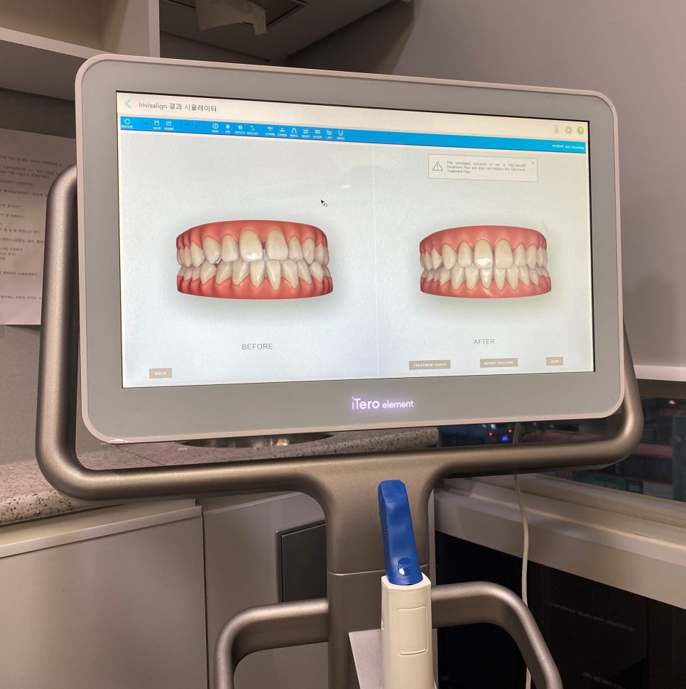 아이테로(iTero) 구강스캐너로 교정전후 시뮬레이션 결과를 확인하실 수 있습니다. 관련 이미지 6