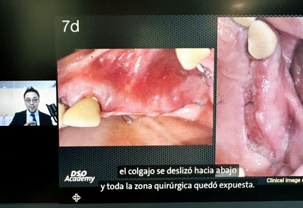 박정철 원장, 급속골이식(iGBR) 노하우를 세계각국으로! 관련 이미지 12