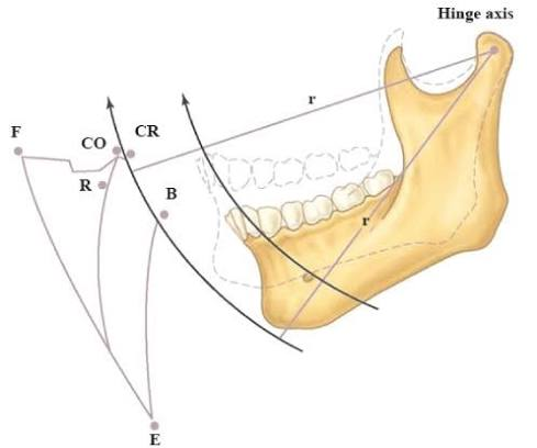 Yonsei Goodday Dental Clinic: Orthodontic Treatment Considering CO-CR Discrepancy image 1