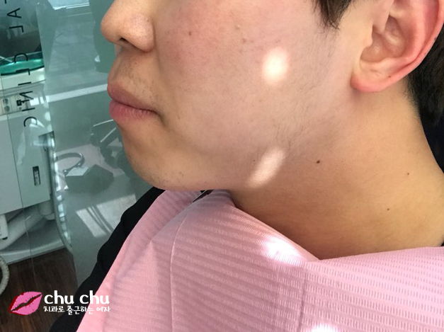 [ 연세굿데이 교정 ] 우리 직원이 달라졌어요 - 돌출입치아교정 start 관련 이미지 1