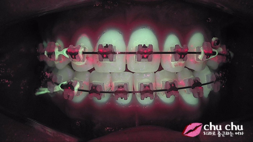 큐레이(Q-ray) &ndash; 플라그형광검사 시스템을 도입했습니다 :) 관련 이미지 7