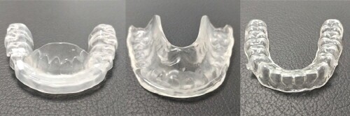 Yonsei Goodday Dental Clinic: Orthodontic Treatment Considering CO-CR Discrepancy image 3