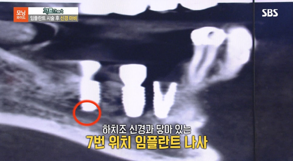 [2018.08.23] SBS모닝와이드 - 수서 연세굿데이 최세경 원장님 방송캡쳐 관련 이미지 8