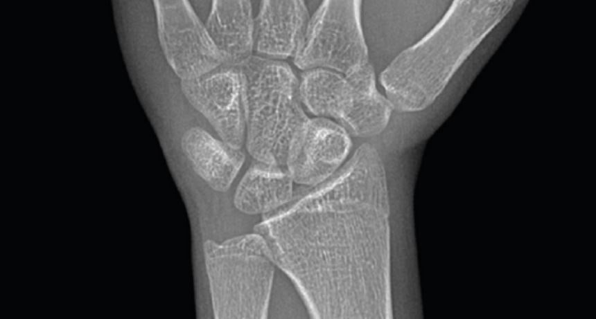 연세굿데이치과] 성장판 검사가 중요한 이유 관련 이미지 4