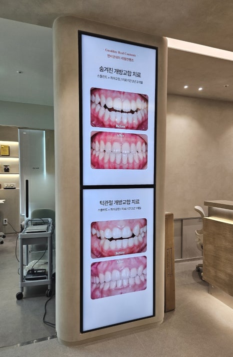 <시공완료> 연세굿데이치과 양재 신축 인테리어 소식 전합니다 관련 이미지 7
