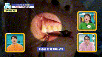 박정철 원장님 MBC 기분좋은날 방송 방영 관련 이미지 16