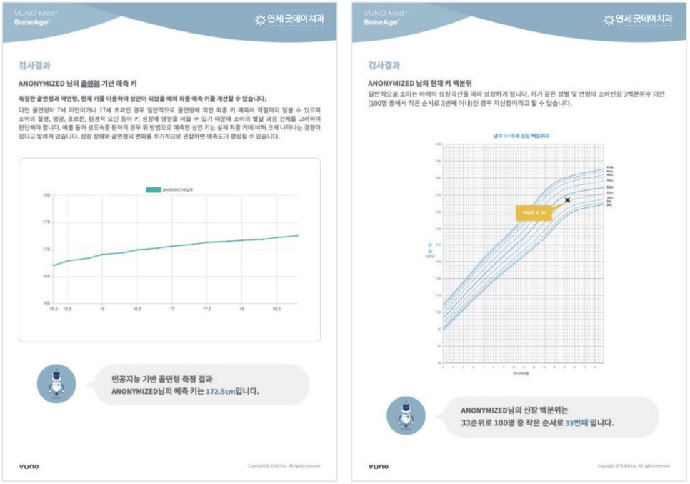 연세굿데이치과] 성장판 검사가 중요한 이유 관련 이미지 9