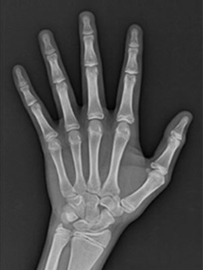 연세굿데이치과] 성장판 검사가 중요한 이유 관련 이미지 1