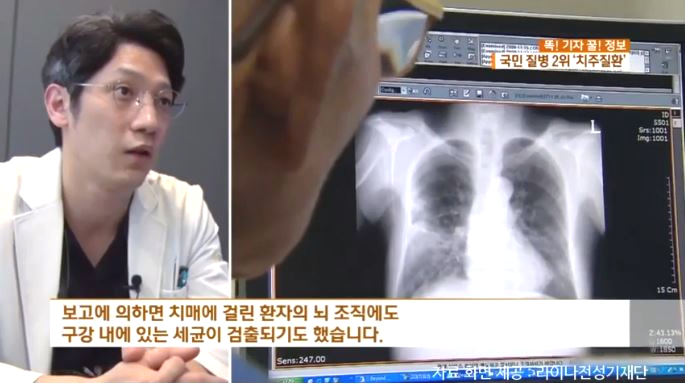 [KBS 아침 뉴스타임] 정재욱원장님 치주질환 인터뷰 방영 (2019. 2. 12) 관련 이미지 6