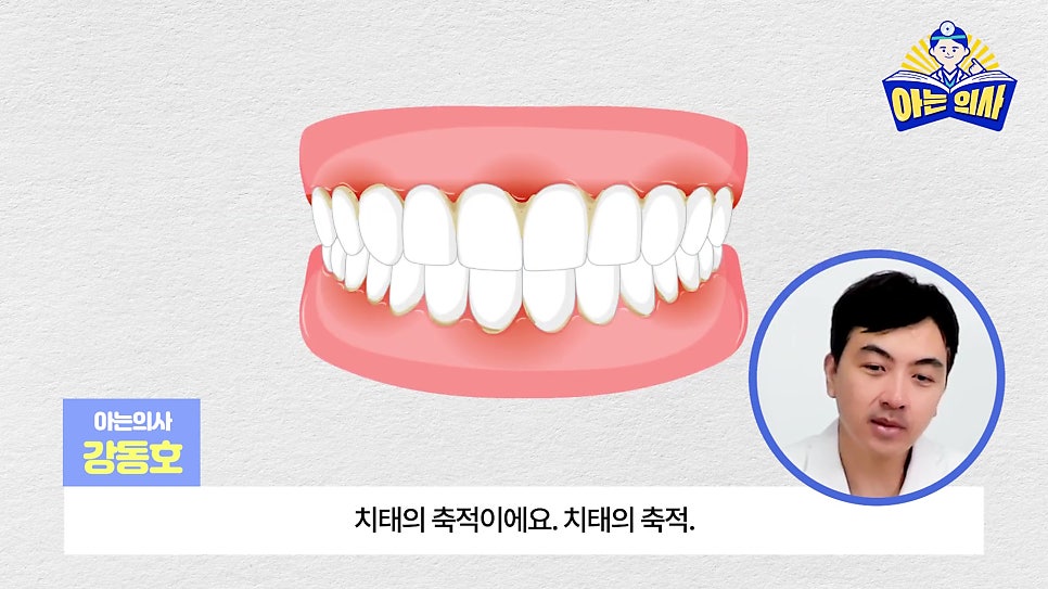 무삭제라미네이트, 단점 알고해야 관련 이미지 6