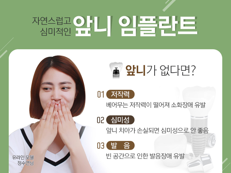 앞니임플란트잘하는곳 정말 중요하죠 관련 이미지 2
