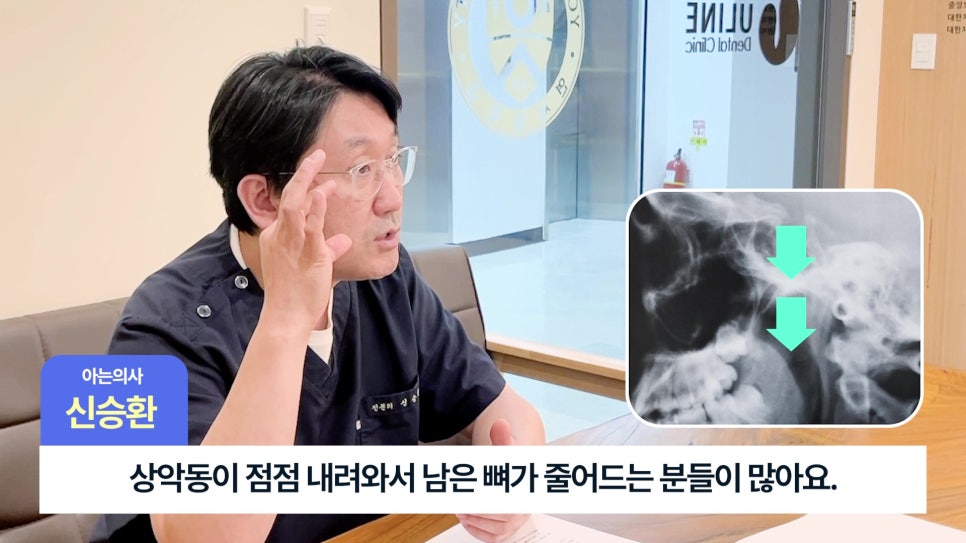 Songpa-gu Dental Implants: Is Sinus Lift Surgery Necessary? image 11