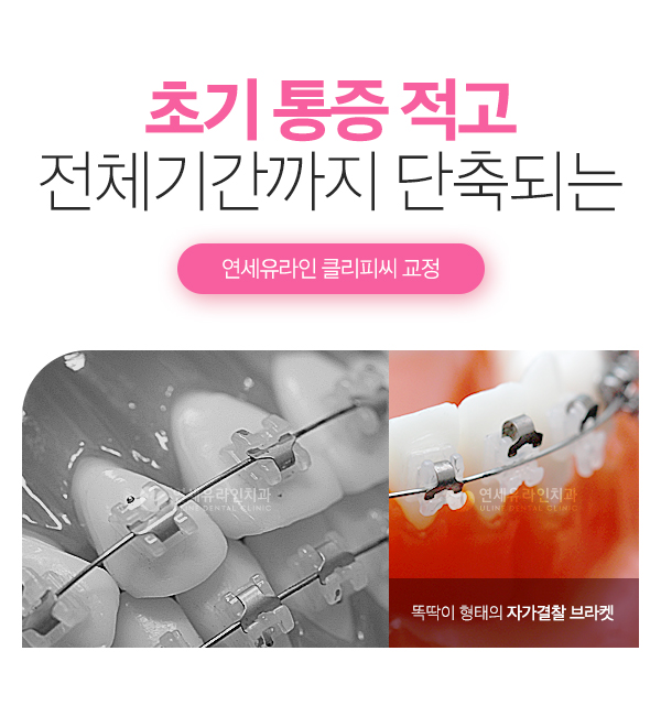 서초동치과 건강과 아름다움을 갖춘 치아 관련 이미지 4