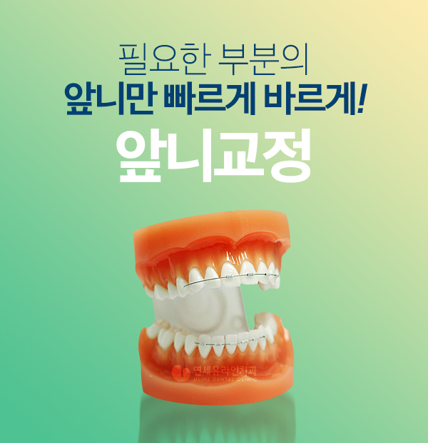 돌출앞니부분교정 예상했던 가격보다 적었어 관련 이미지 1