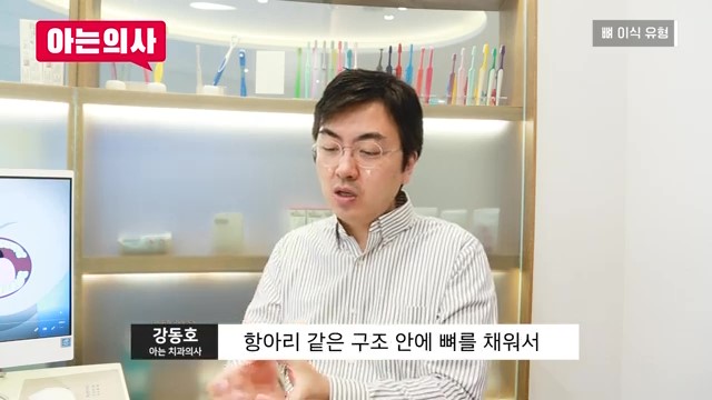 임플란트, 뼈이식 꼭 해야하는 케이스는? 관련 이미지 4