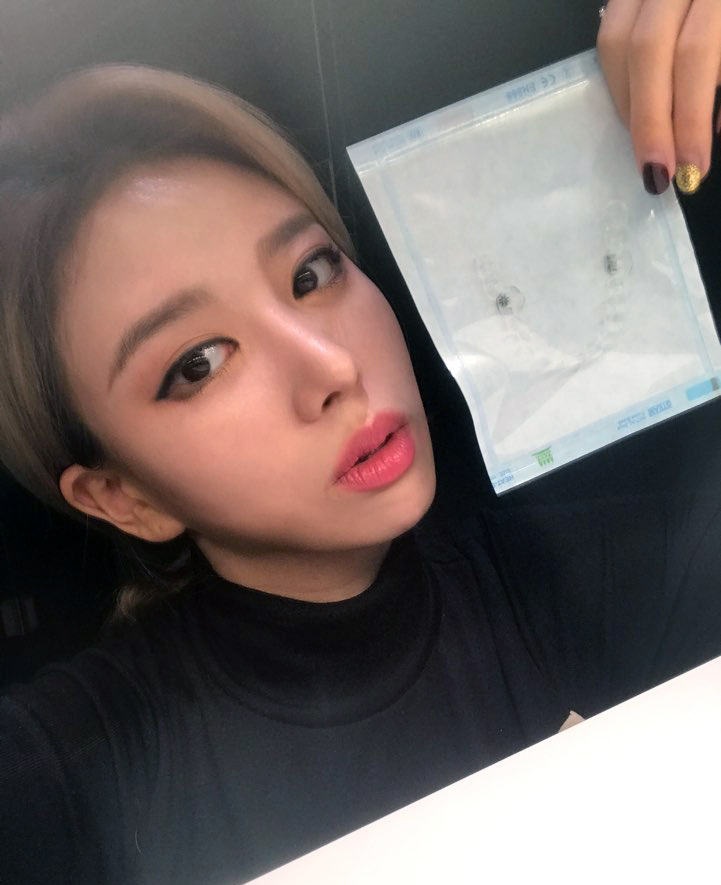 봉천역치과 불편함을 벗어던지고 관련 이미지 1