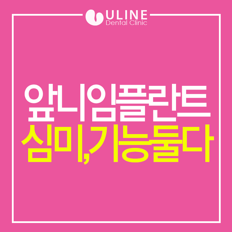 앞니임플란트가격 대비 뛰어나 관련 이미지 1