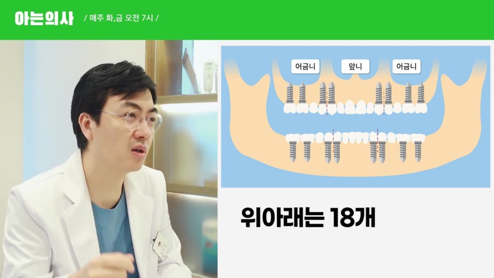 관악구임플란트, 최소 몇개? 관련 이미지 9