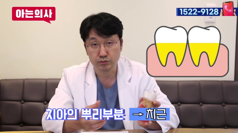 Does a Chipped or Broken Tooth Always Require an Implant? image 3
