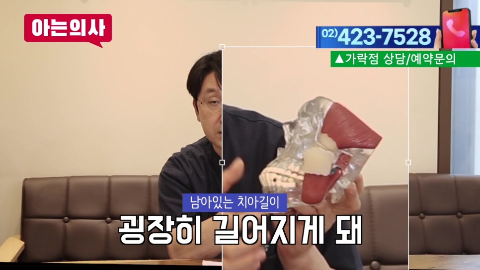 가락동치과 - 잇몸병, 끝까지 버티면.. 관련 이미지 16