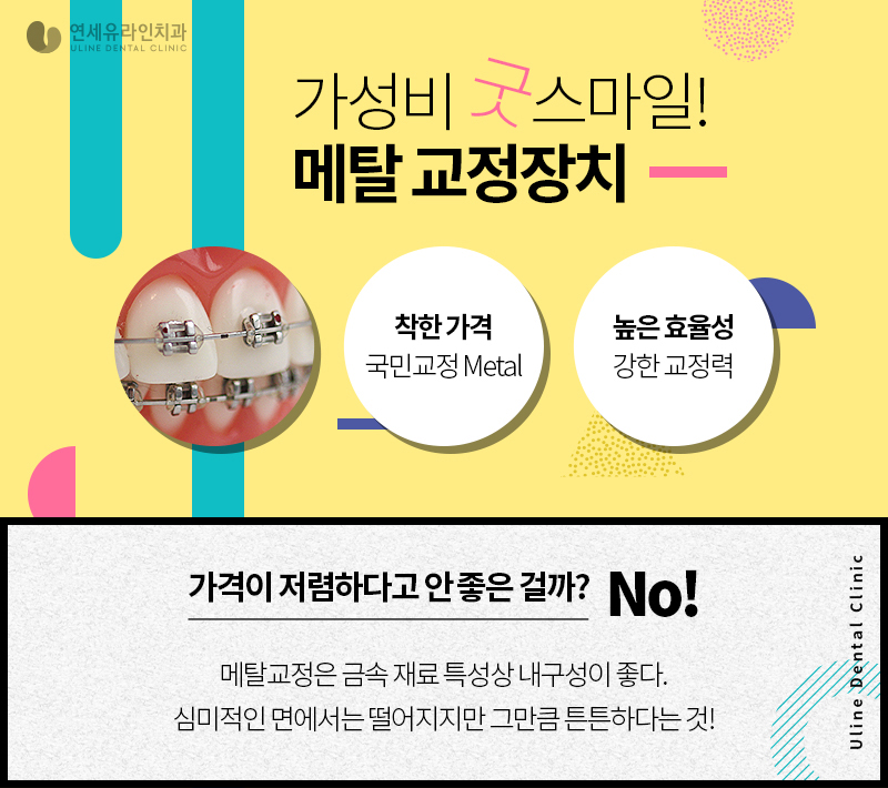 돌출입 세라믹교정 메탈교정 뭐가 좋을까! 관련 이미지 4