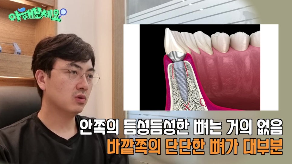 역삼역임플란트치과, 젊은층도 실패를? 관련 이미지 18