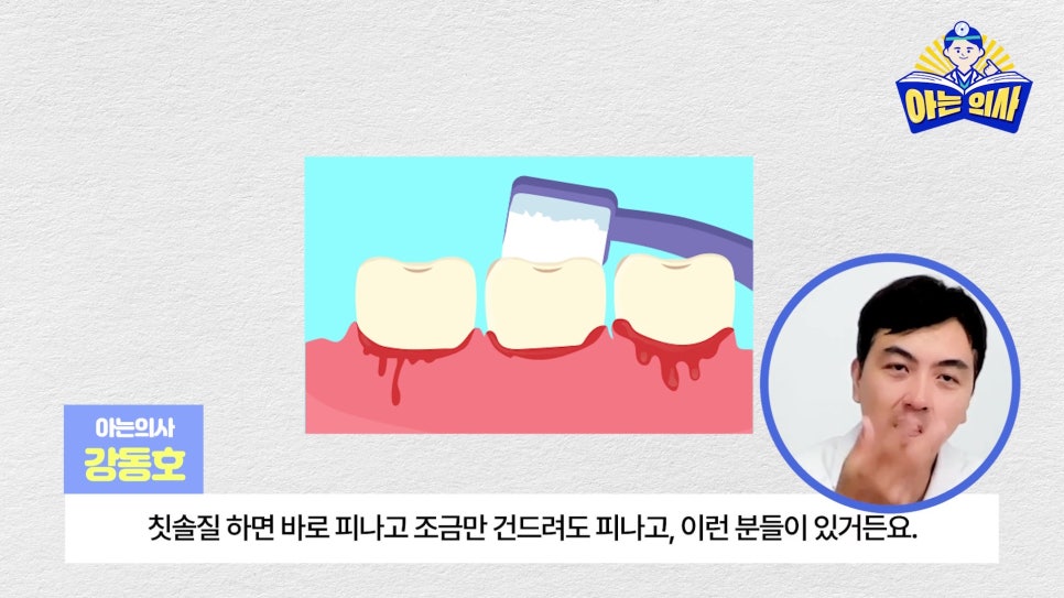무삭제라미네이트, 단점 알고해야 관련 이미지 16