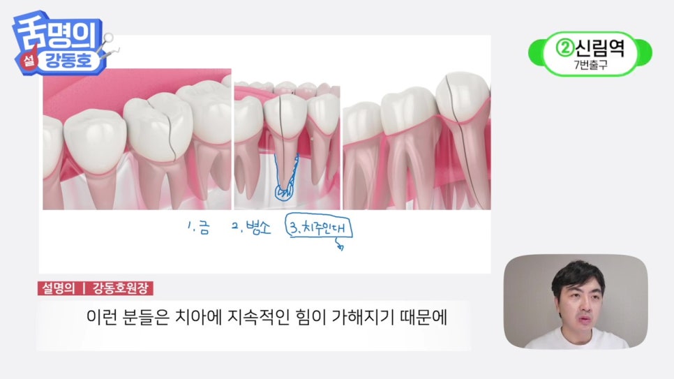 역삼역야간진료치과, 씹을 때마다 아파? 관련 이미지 29