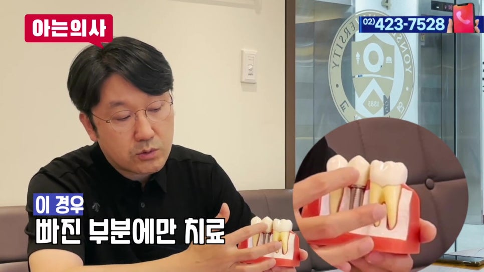 임플란트 vs 브릿지, 내게 이로운 선택은?! 관련 이미지 6