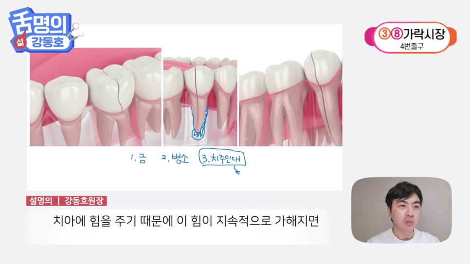 역삼역야간진료치과, 씹을 때마다 아파? 관련 이미지 23
