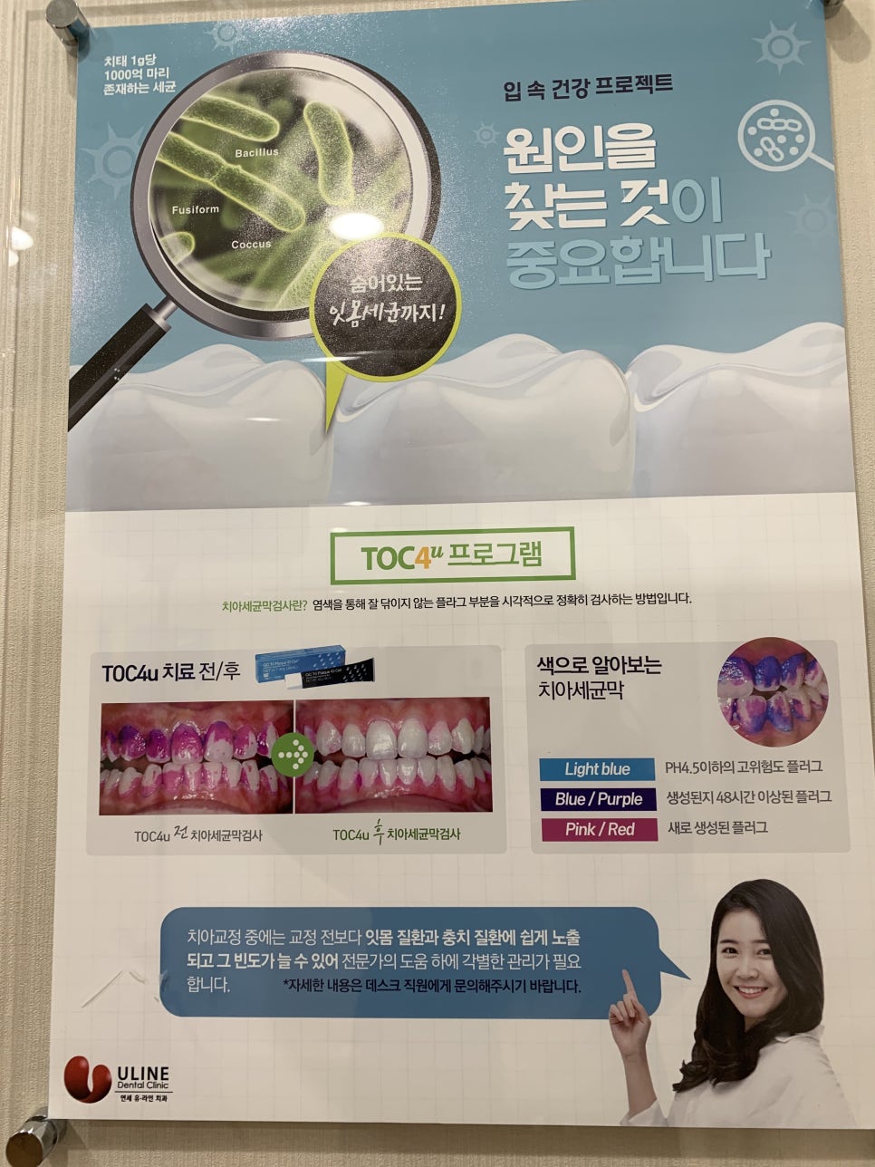 어금니임플란트가격 안전하게 접근하기 관련 이미지 4