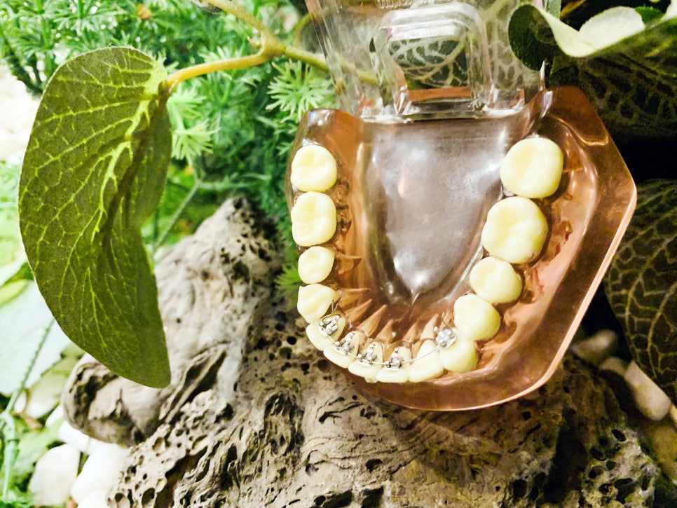사당역치과 고르게 바르게 예쁘게 관련 이미지 2
