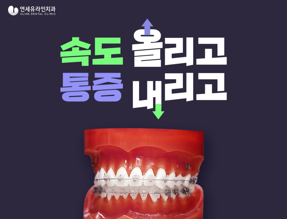 클리피씨교정기간 이렇게나 단축되다니! 관련 이미지 5