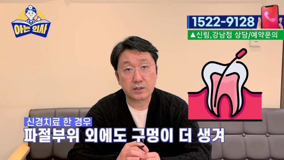 가락동치과 - 치아가 깨졌을때 상황별 치료 정리 관련 이미지 29