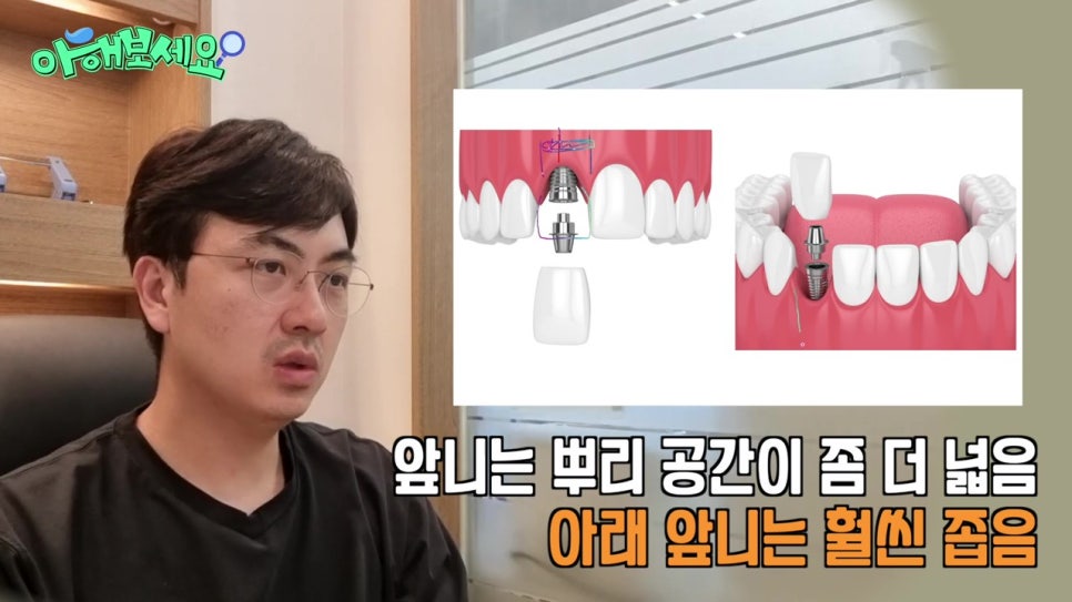 역삼역임플란트치과, 젊은층도 실패를? 관련 이미지 10