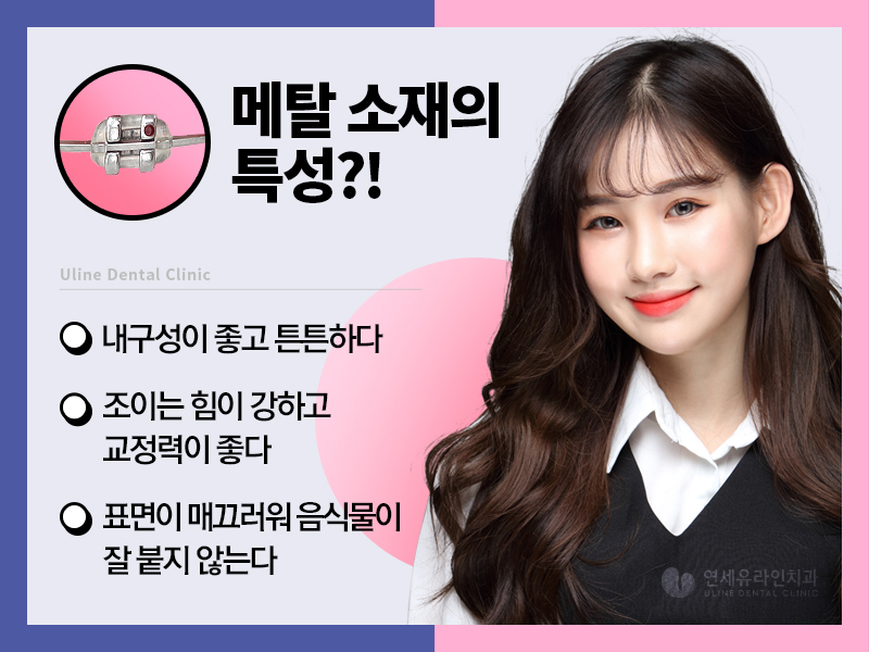돌출입 세라믹교정 메탈교정 뭐가 좋을까! 관련 이미지 3
