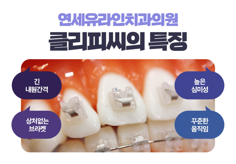 클리피씨교정기간 이렇게나 단축되다니! 관련 이미지 7