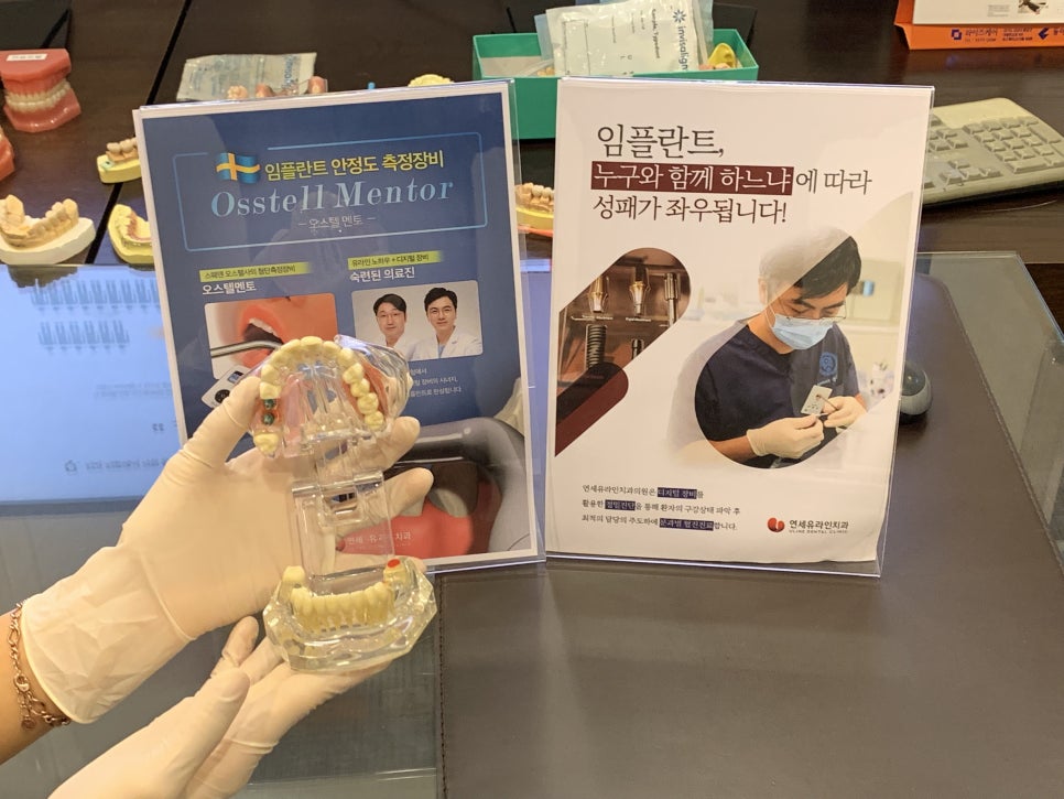 어금니임플란트가격 안전하게 접근하기 관련 이미지 5