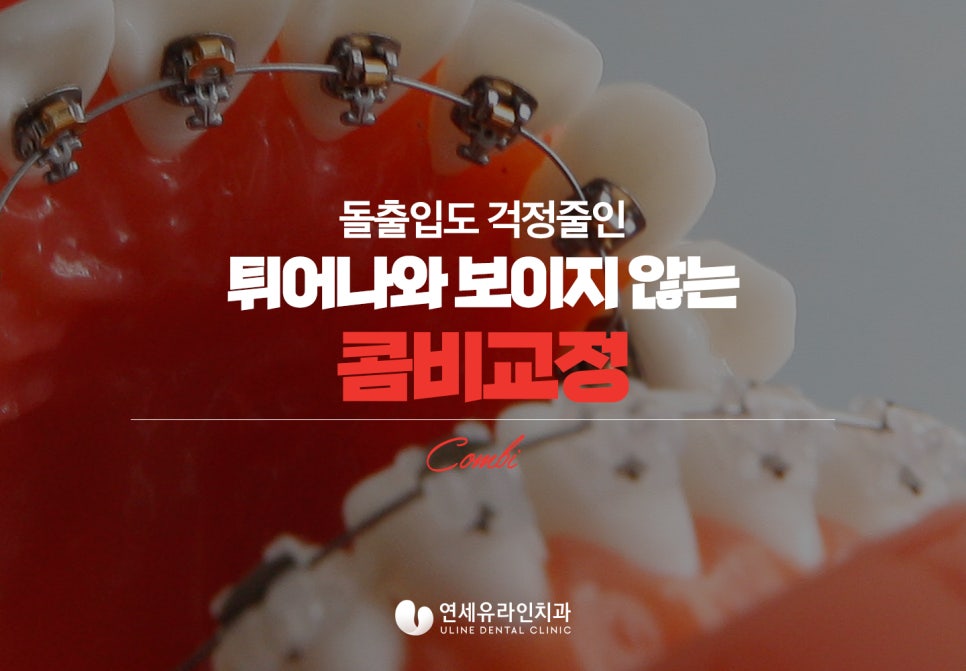 신대방역치과 두가지 모두를 한번에 누리자! 관련 이미지 6