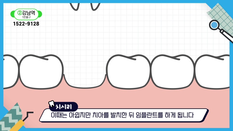 신림역치과 - 치아 균열은 자연 회복되지 않아 관련 이미지 10