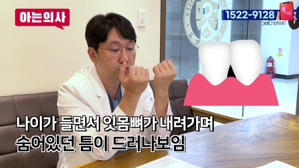 신림야간진료, 치아사이 까만틈 없애려면 관련 이미지 9