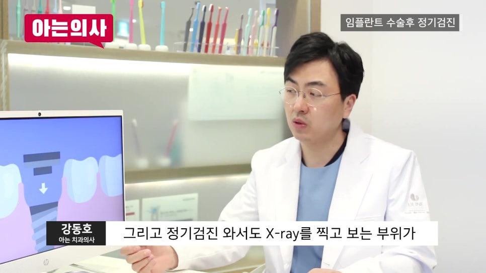 신림역임플란트 후, 정기검진 안 하면 관련 이미지 18