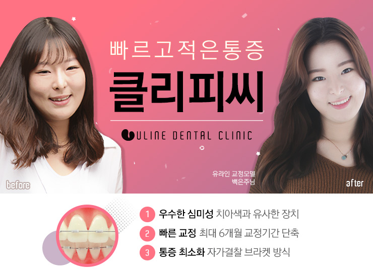 강남역치과 일석이조의 기쁨을 누리고 싶다면 관련 이미지 7