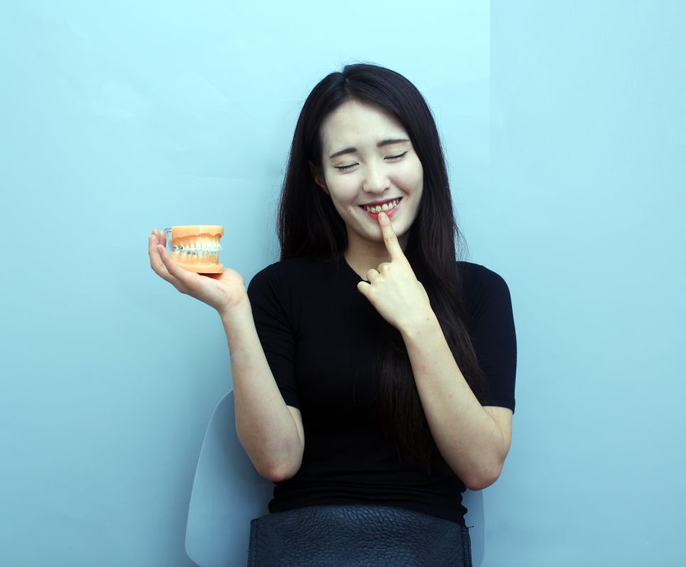 토끼앞니교정 치열로 생긴 별명 싫어! 관련 이미지 3